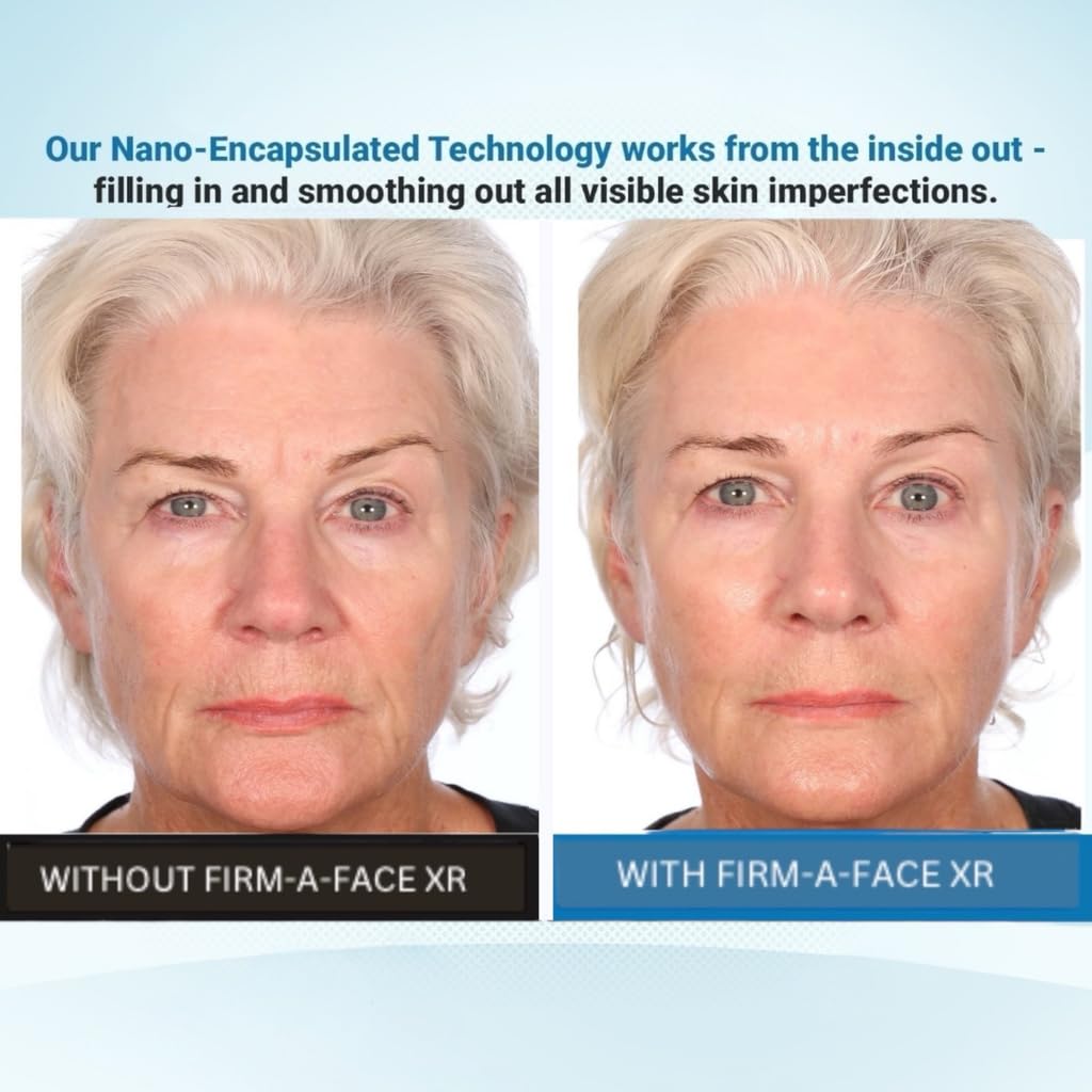 Applying Firm A Face XR on the face for a visible lift