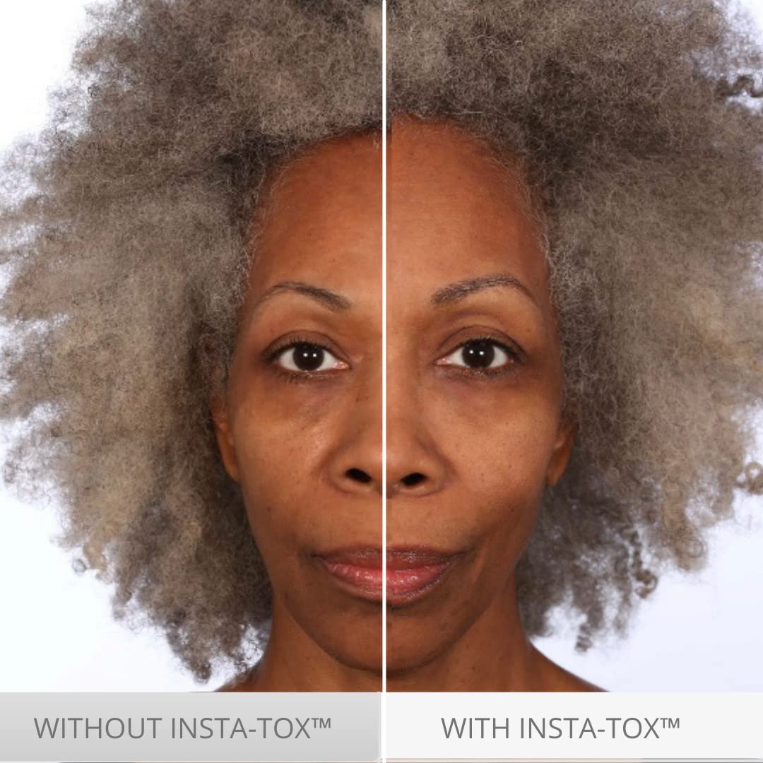 INSTA-TOX eye area softening for a refreshed appearance