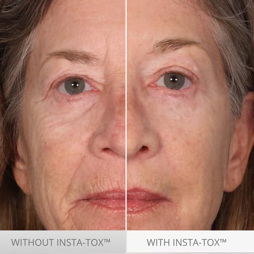 INSTA-TOX face wrinkle smoothing detail focusing on fine lines