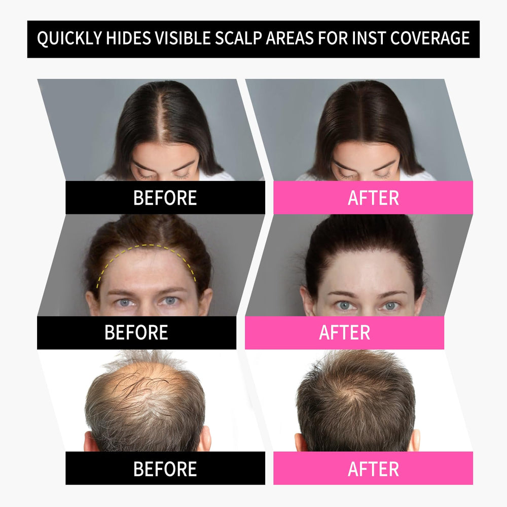 Sevich Hairline Powder color options swatch page shows shade variety.