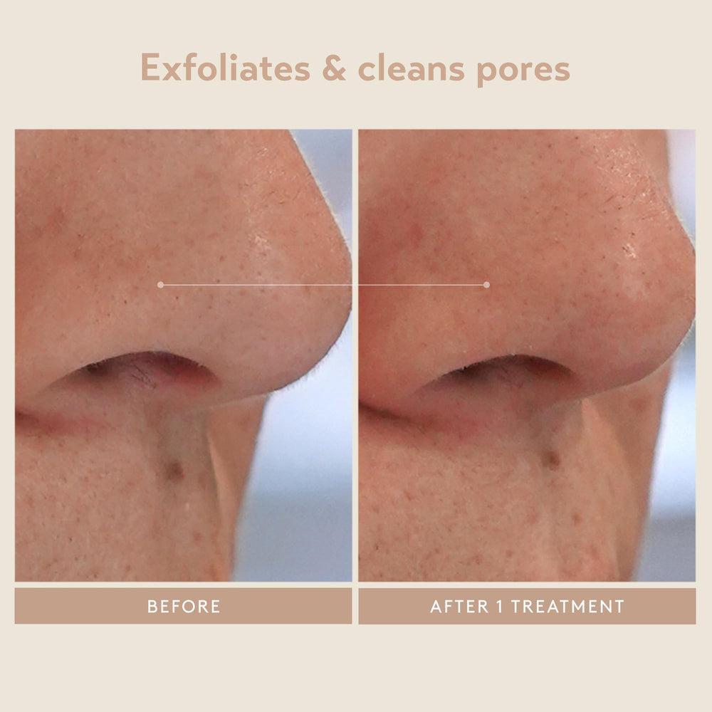 SHANI DARDEN Kaolin Clay detail highlighting impurity removal and pore clarity