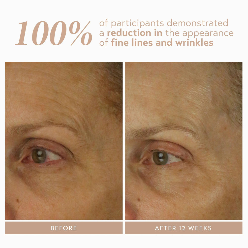 SHANI DARDEN Retinol Reform encapsulation graphic, illustrating slow-release technology.