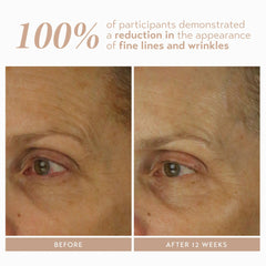 SHANI DARDEN Retinol Reform encapsulation graphic, illustrating slow-release technology.