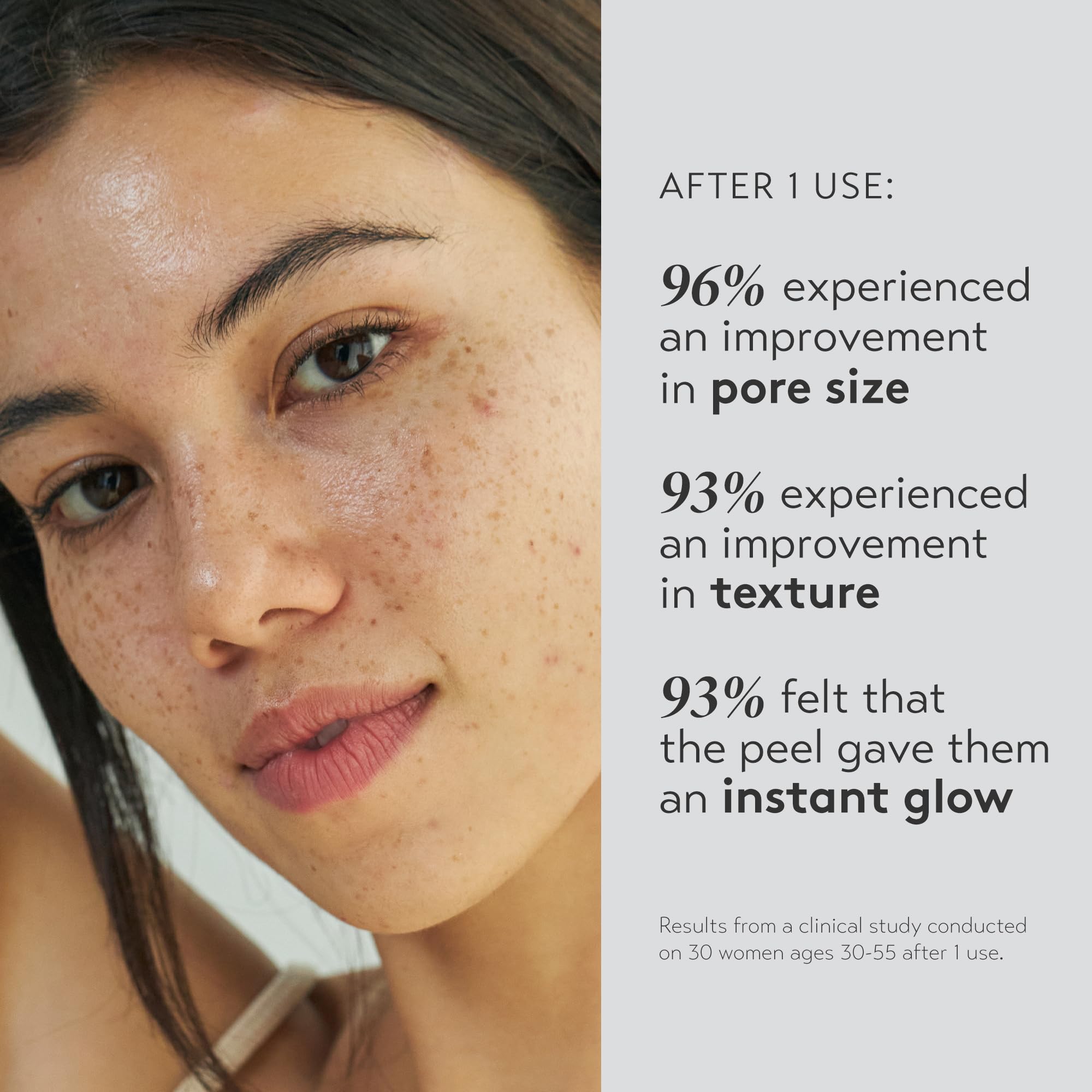 SHANI DARDEN Triple Acid Peel application showing exfoliation for smoother skin
