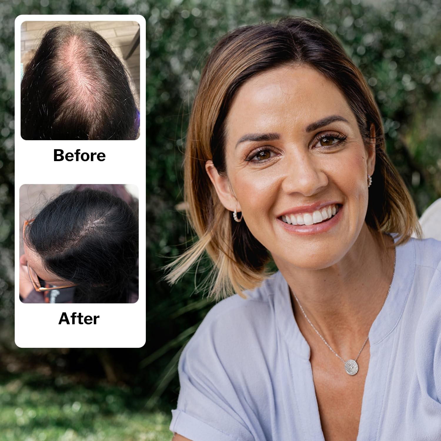 Shapiro MD Regrowth Kit Plus leave-in foamer foam for quick styling.