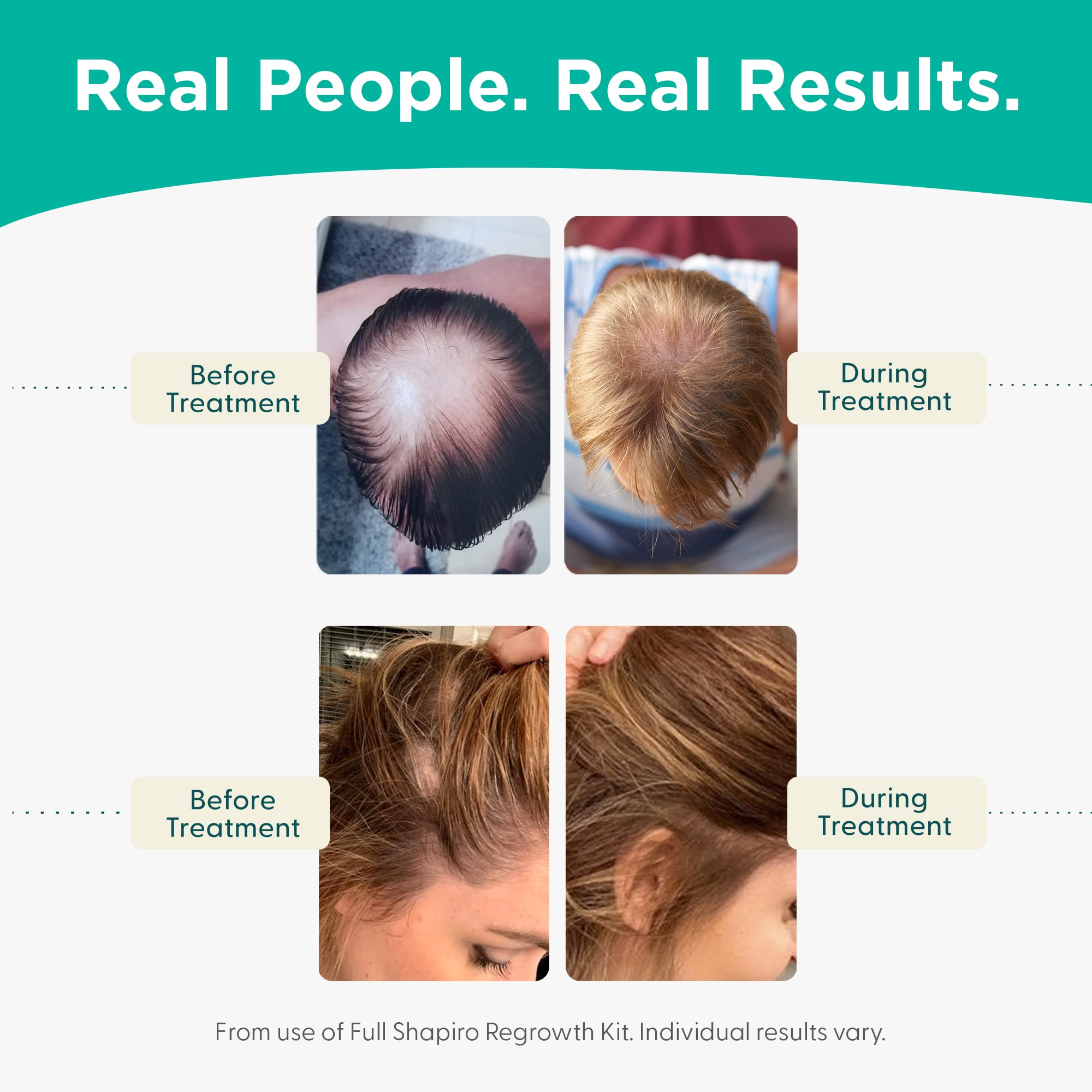 Shapiro MD vegan shampoo foamy lather in hand showing gentle cleansing