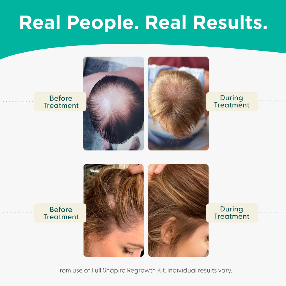 Shapiro MD vegan shampoo foamy lather in hand showing gentle cleansing
