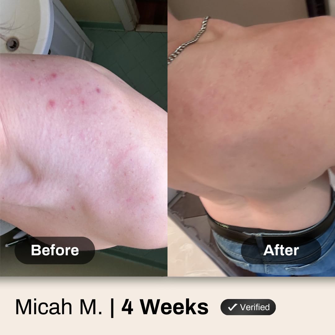 Shield after-workout cleanse close-up highlights sweat removal and refreshed skin.