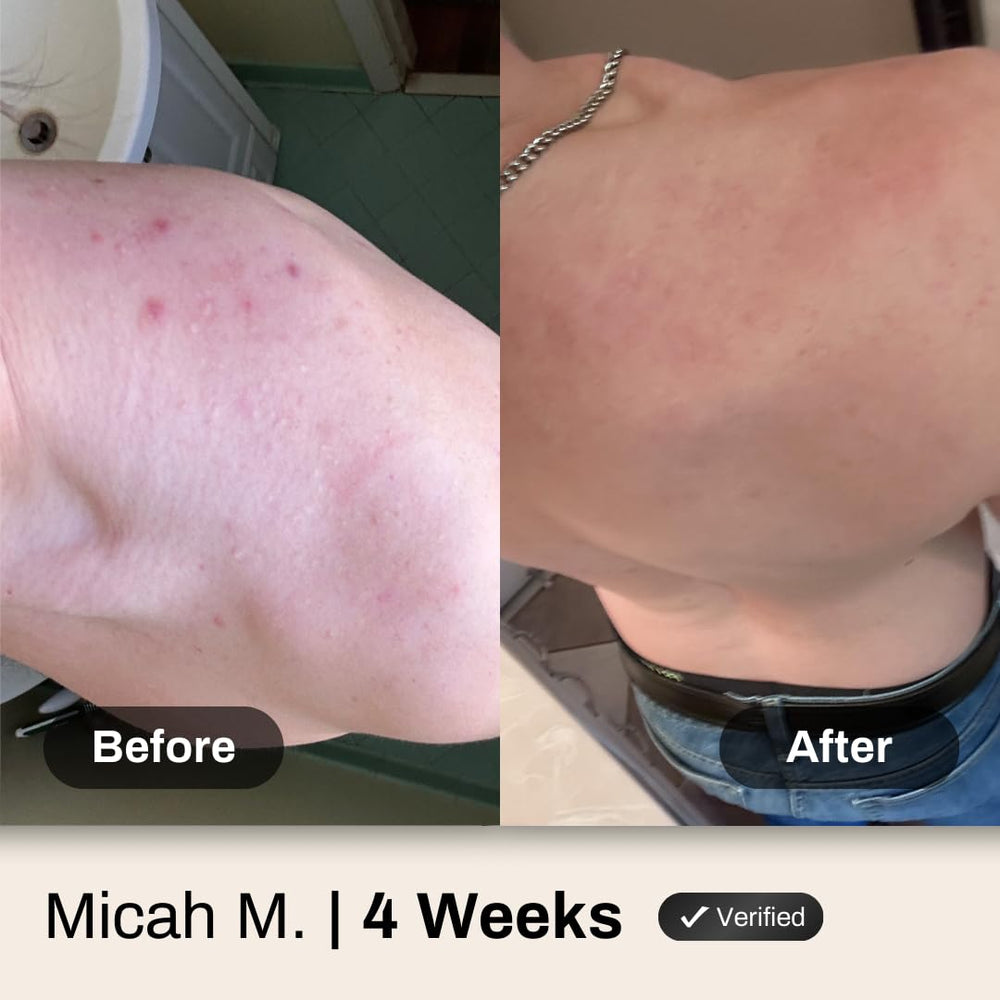 Shield after-workout cleanse close-up highlights sweat removal and refreshed skin.