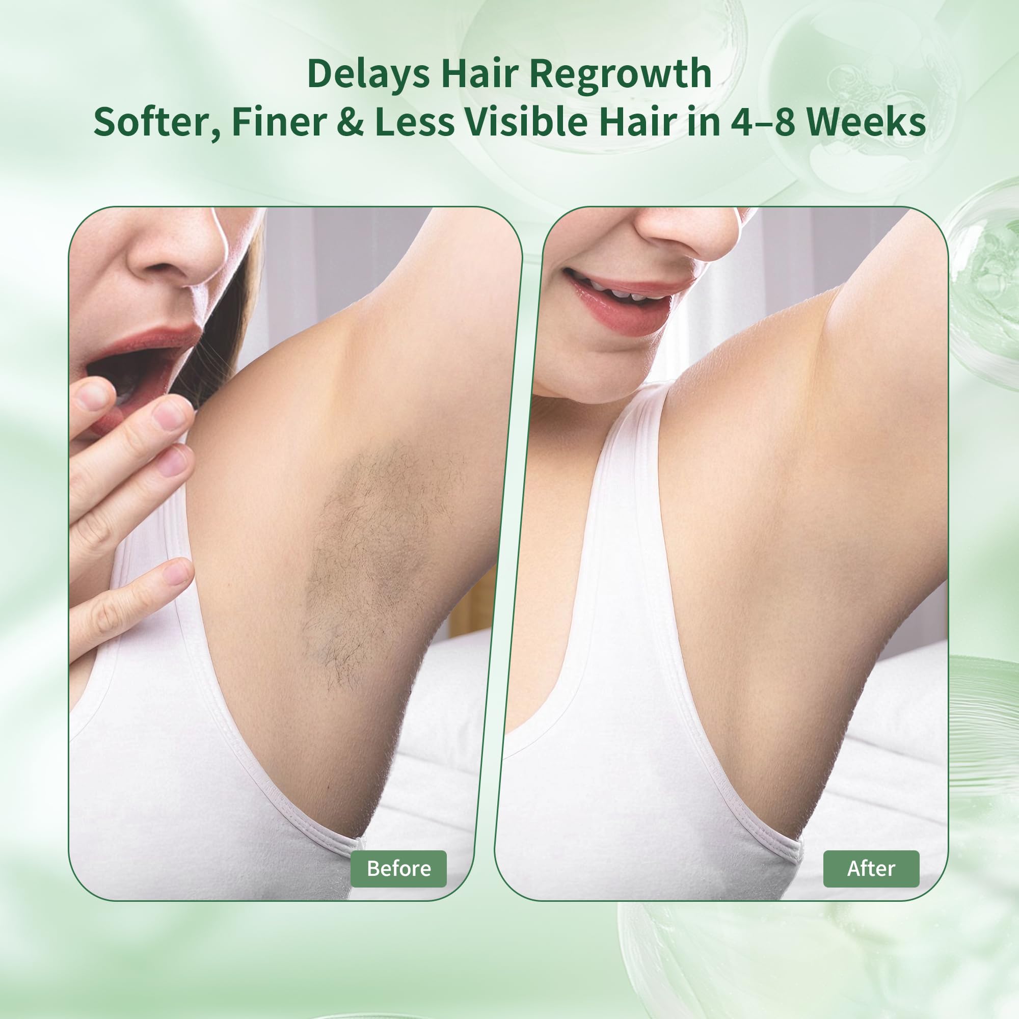 ShineMore oil application after hair removal for post-treatment nourishment.