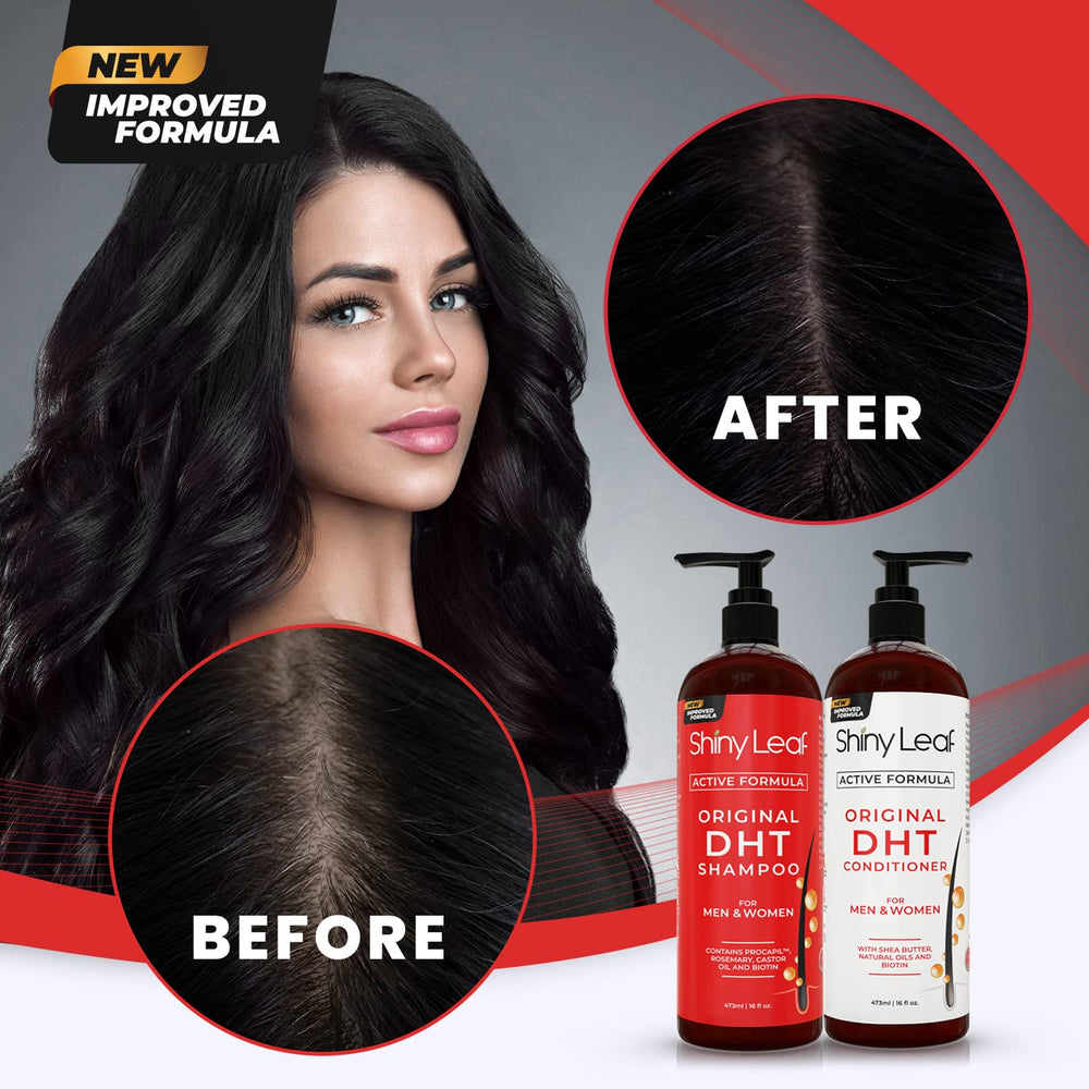 Shiny Leaf DHT Blocker biotin enrichment on packaging