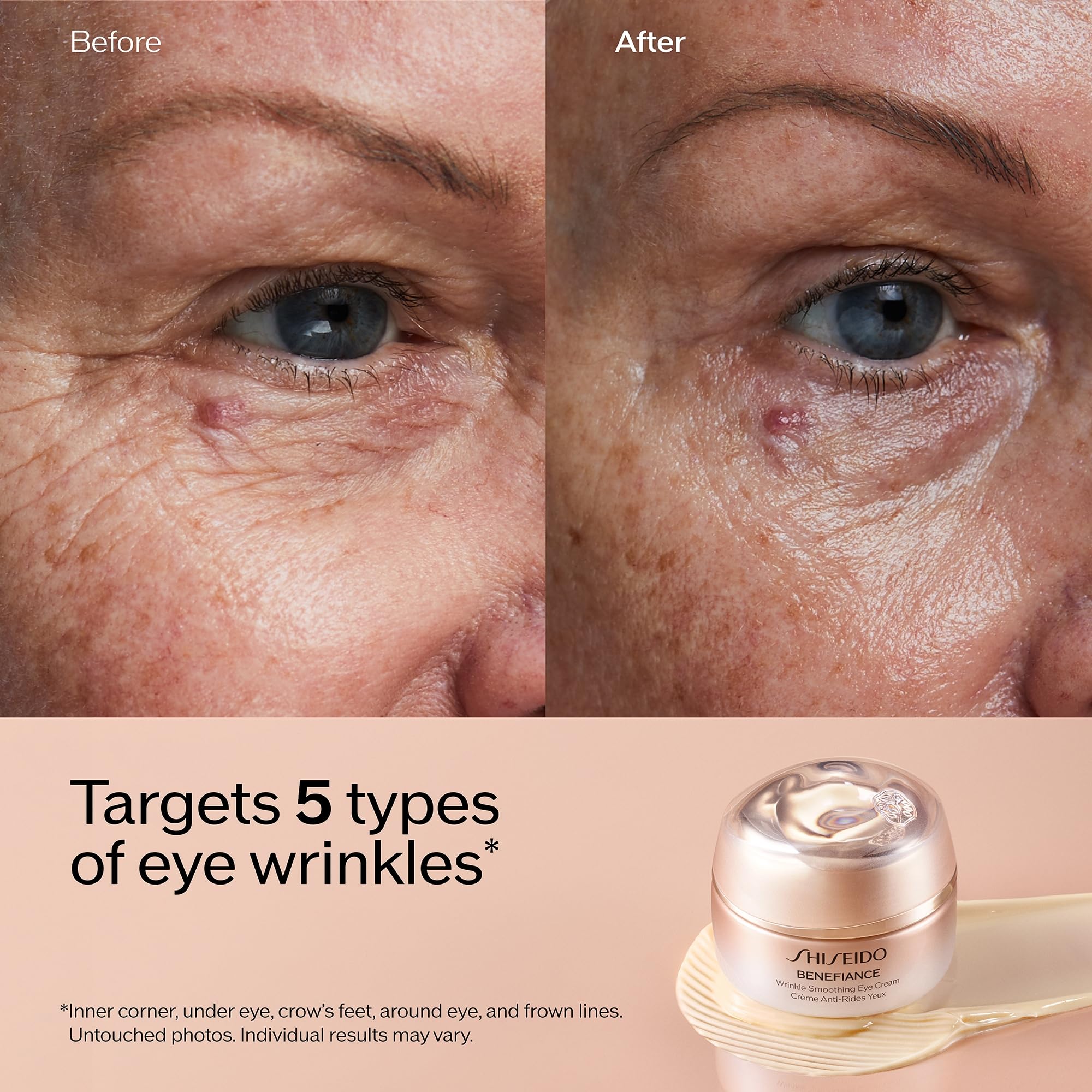 Five-wrinkle area focus around the eye with Shiseido Benefiance eye cream