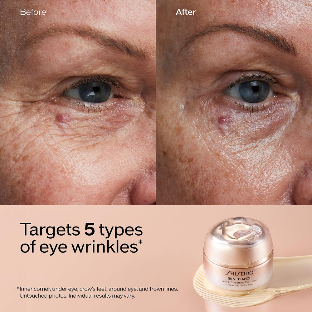 Five-wrinkle area focus around the eye with Shiseido Benefiance eye cream