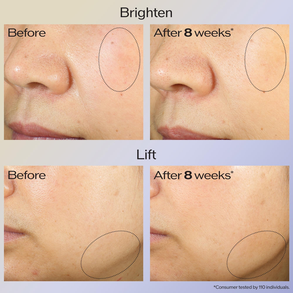Two drops on five facial areas instruction visual cue for application.