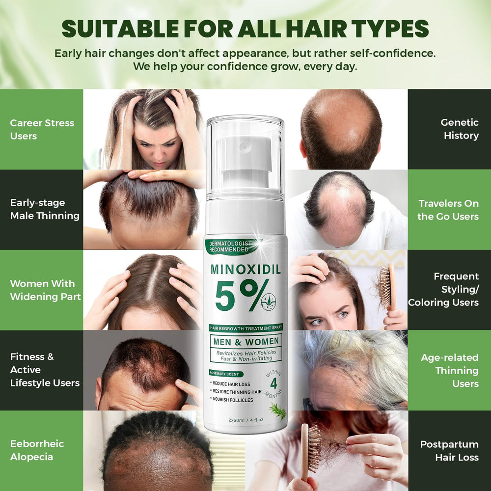 SHIUMORE minoxidil rosemary spray sleek bottle conveys lightweight daily use.
