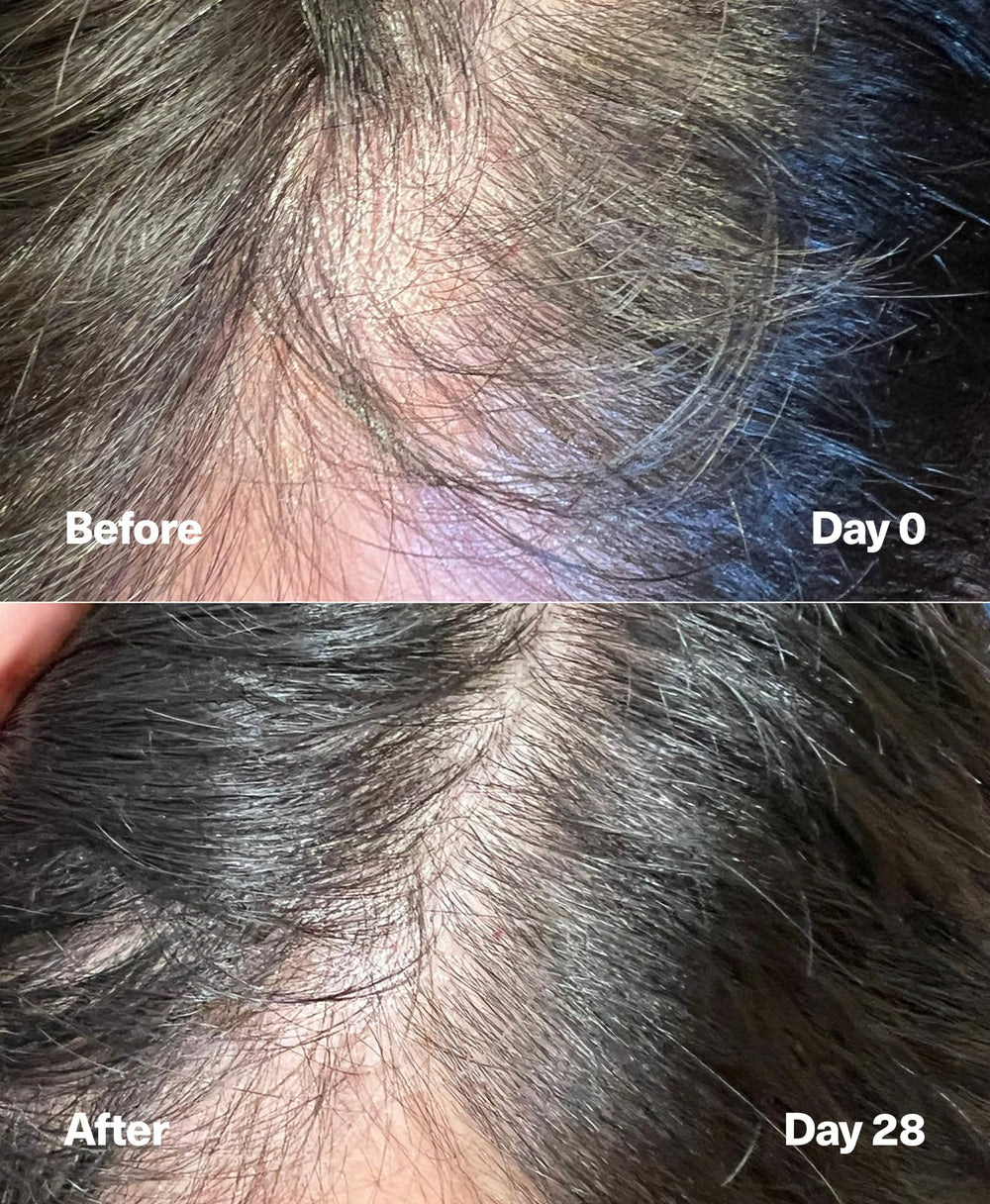 SickScience PowerCycle morning-night application ready for routine use