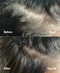 SickScience PowerCycle scalp massage shows soothing application on clean scalp