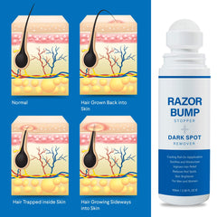Sielkin Razor Bump Stopper roll-on on bikini area soothing irritation.