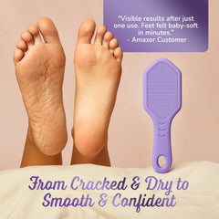 SILKLE Foot File smoothing cracked heels during a pampering shower routine.