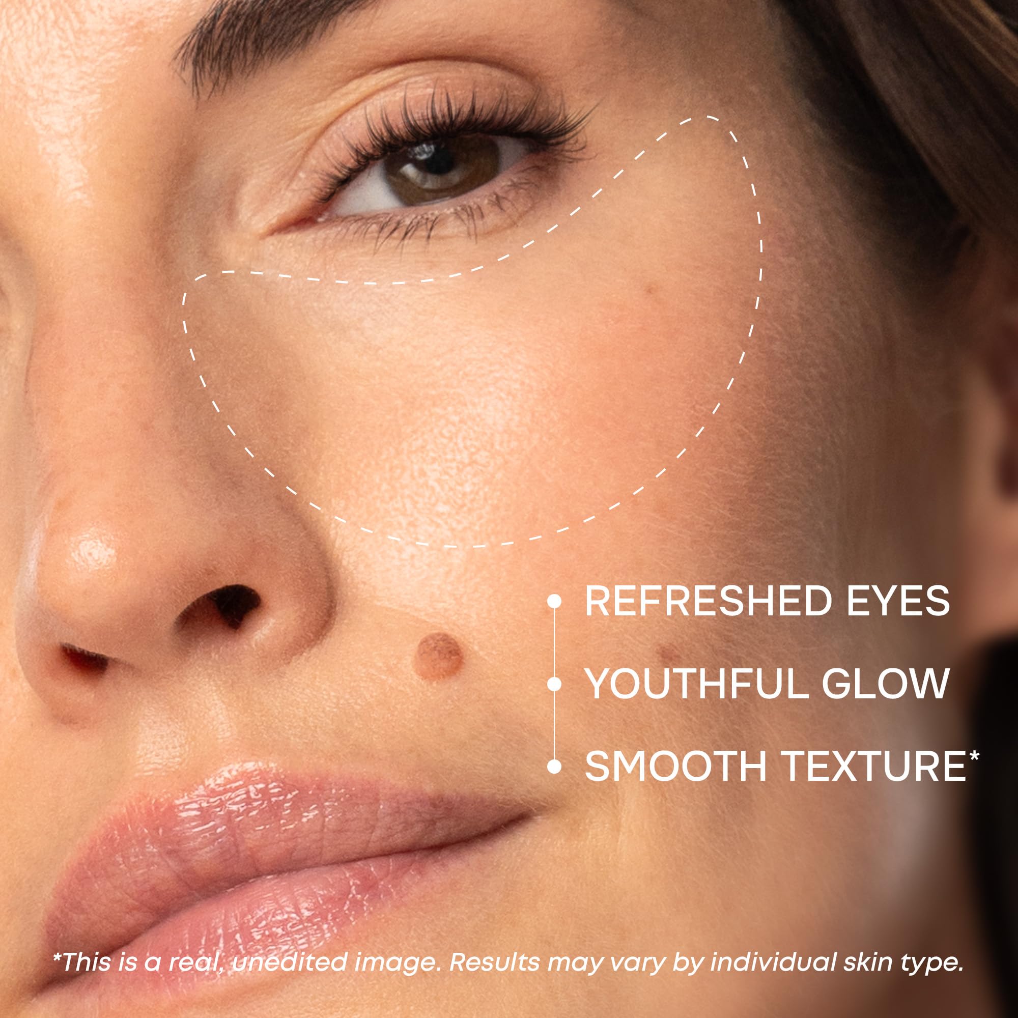 Parches SimplyVital ojeras con colágeno para suavizar la textura de la piel.