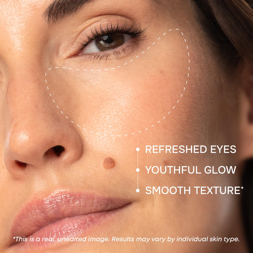 Parches SimplyVital ojeras con colágeno para suavizar la textura de la piel.
