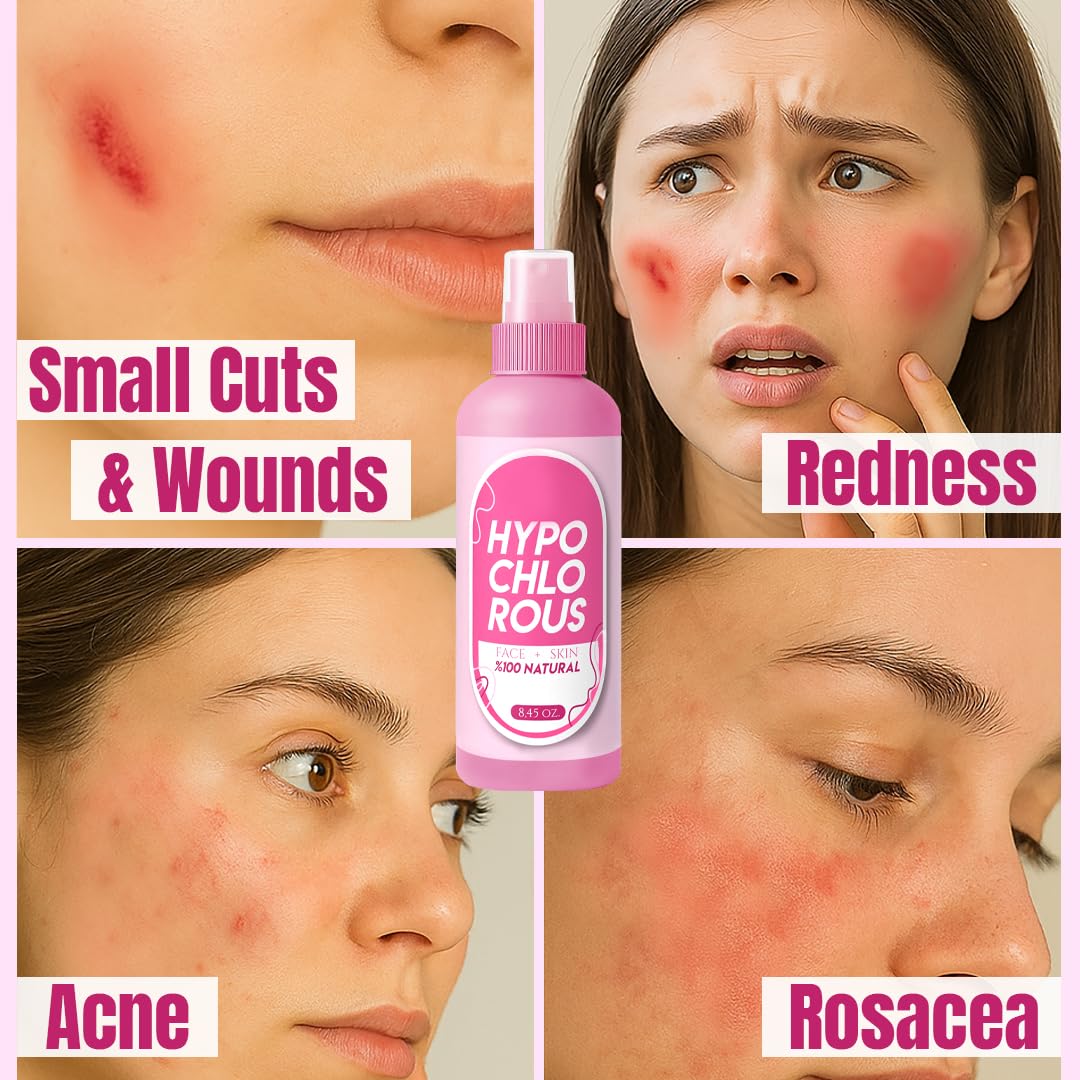 GÜLLÜOGLU HOCl Spray: envase práctico para gimnasio y viaje.