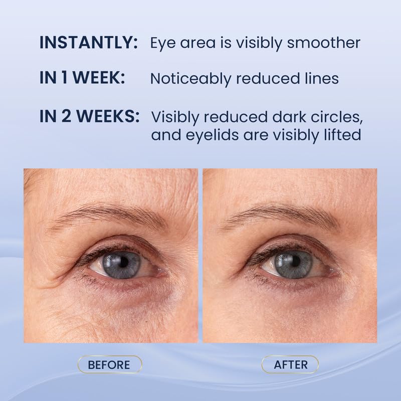 Skin Ultima retinol-peptidos-cafeina mejora la textura de la zona ocular.