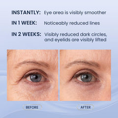Skin Ultima retinol-peptidos-cafeina mejora la textura de la zona ocular.