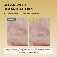 SKIN1004 Desmaquillante Aceite Facial: uso diario que disuelve maquillaje sin residuo pesado