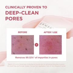 Desmaquillante diario SKIN1004 Poremizing Foam para retirar maquillaje y sebo.