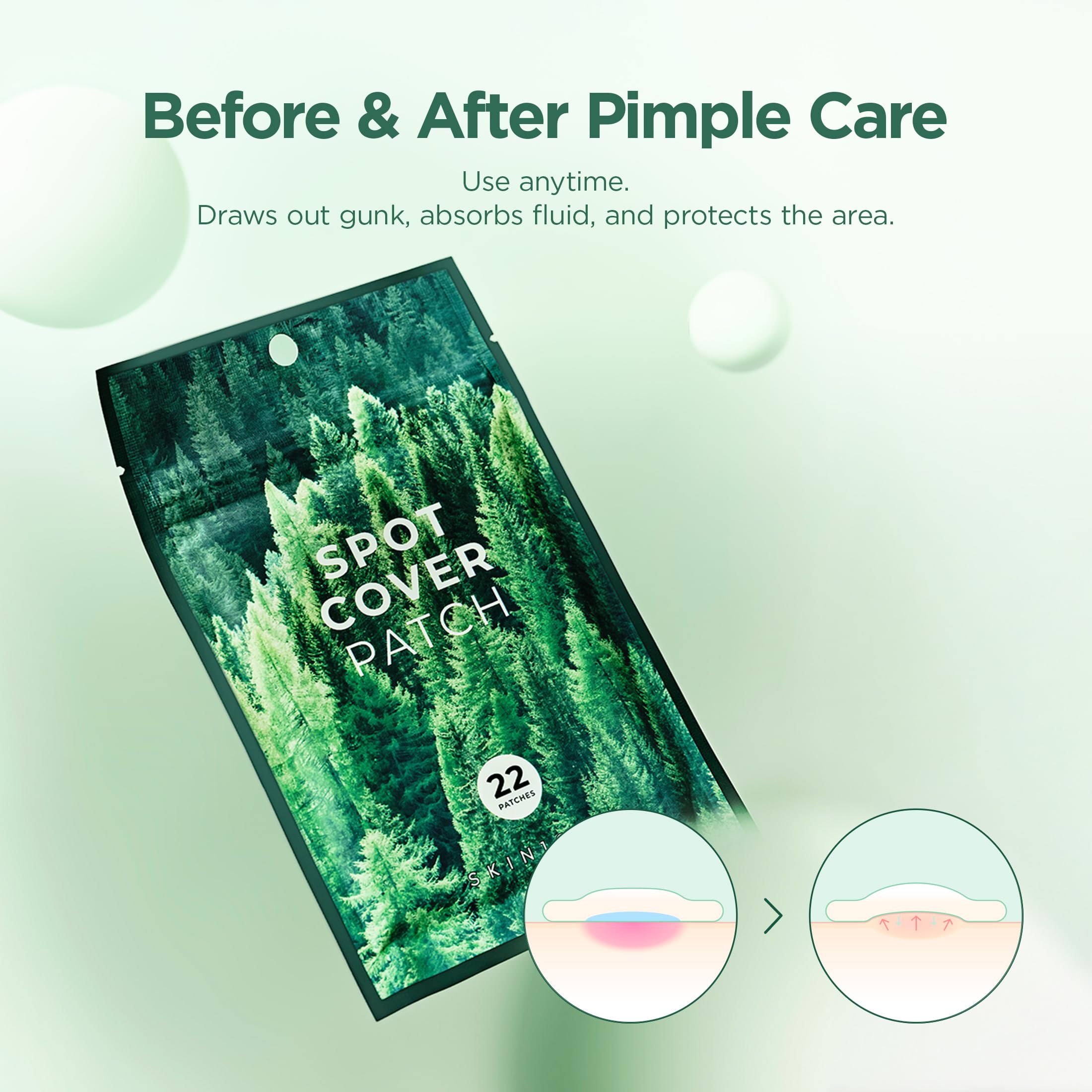 Dermatologically tested, non-comedogenic SKIN1004 Tea Trica Patch is skin-safe.