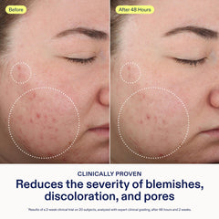 Skinfix 2% BHA Cleanser ingredient close-up showing actives.