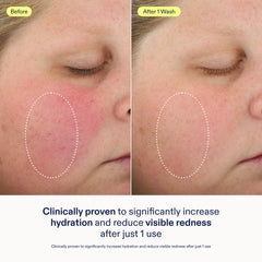 Skinfix Barrier Cleanser creamy gel texture ideal for a soothing massage on damp skin.