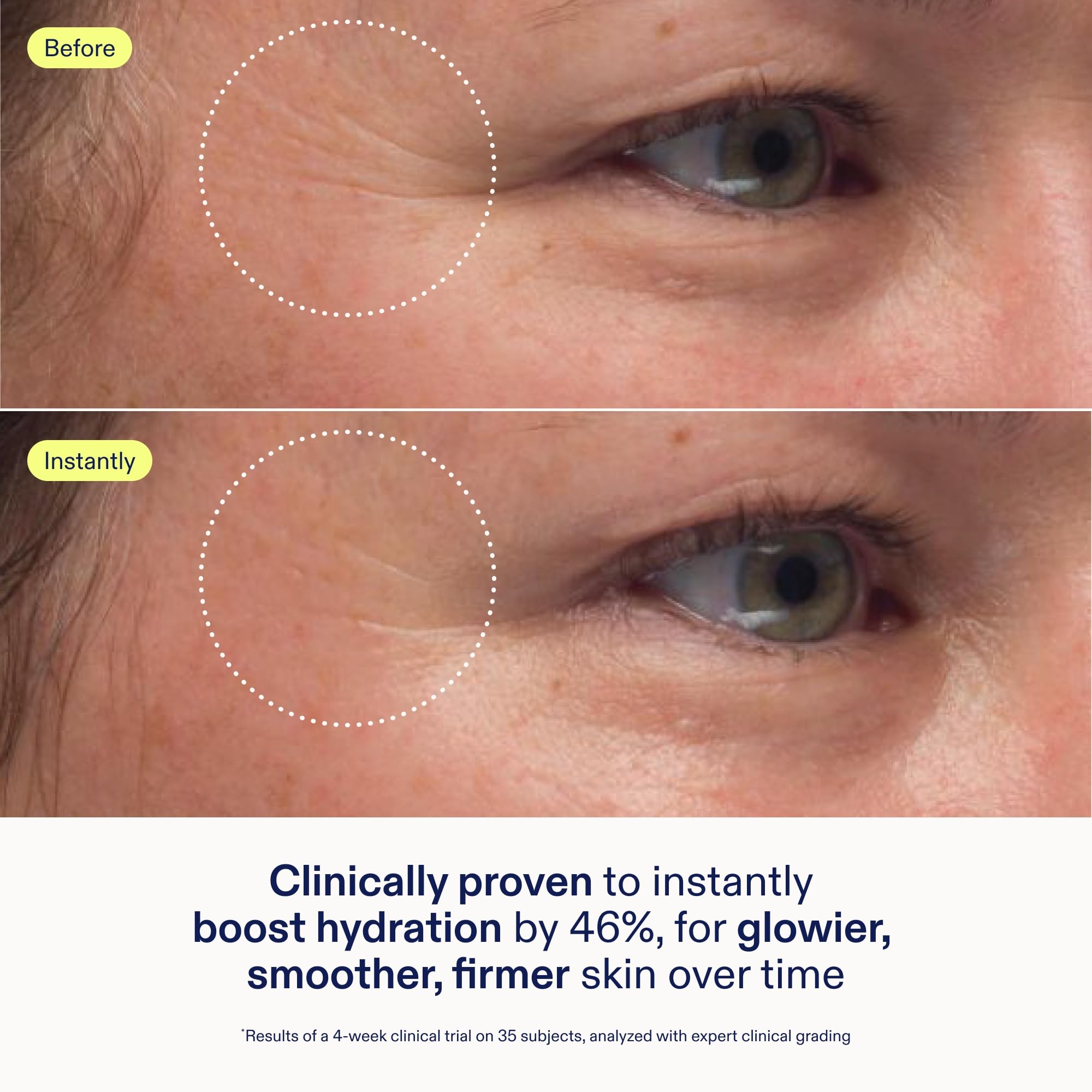 Skinfix Triple Lipid-Peptide Cream Refill jar close-up showing creamy texture.