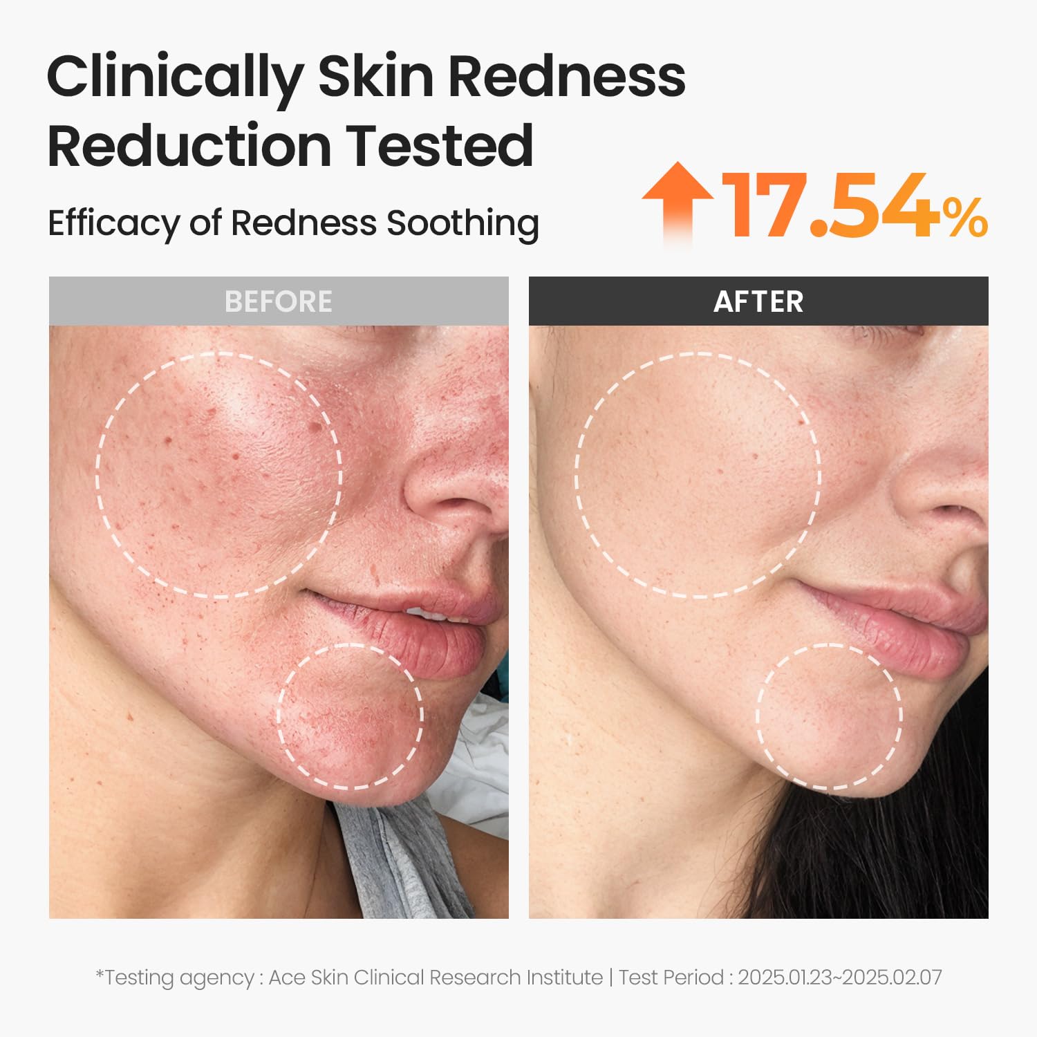 Después del sol, sensación fresca de SKINFOOD Carrot Toner Pad alivia