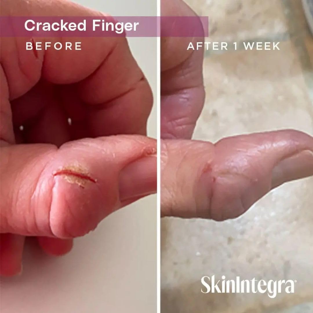 SkinIntegra Rapid Crack Repair Cream ingredients with 25% urea and lactic acid.