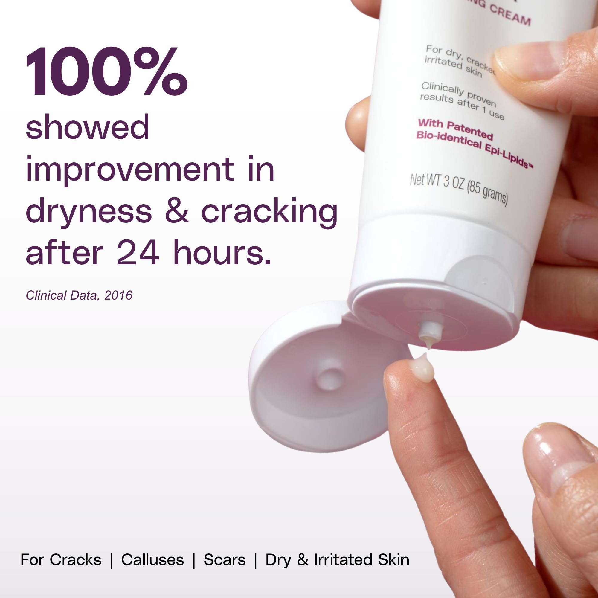 SkinIntegra Rapid Crack Repair Cream application on feet for deep hydration.