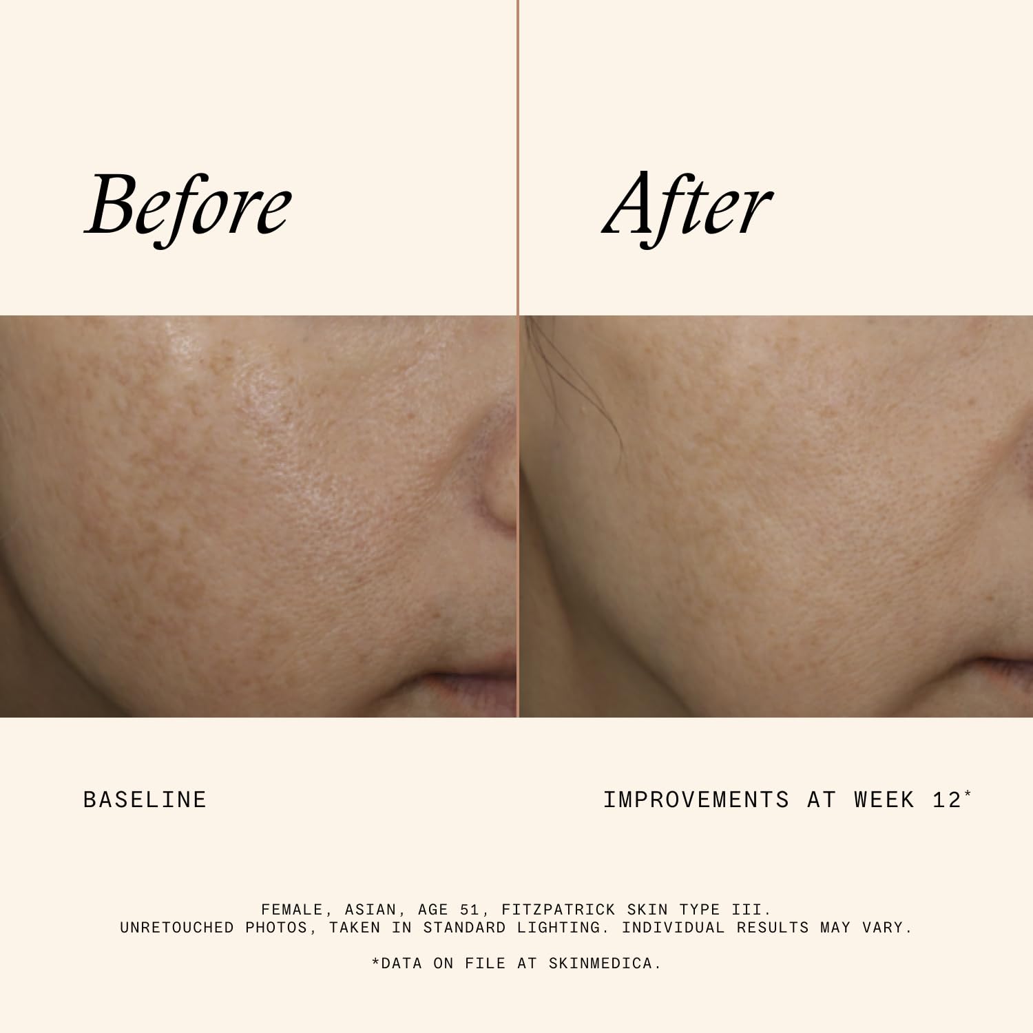 Close-up texture of SkinMedica Even & Correct serum for lightweight feel