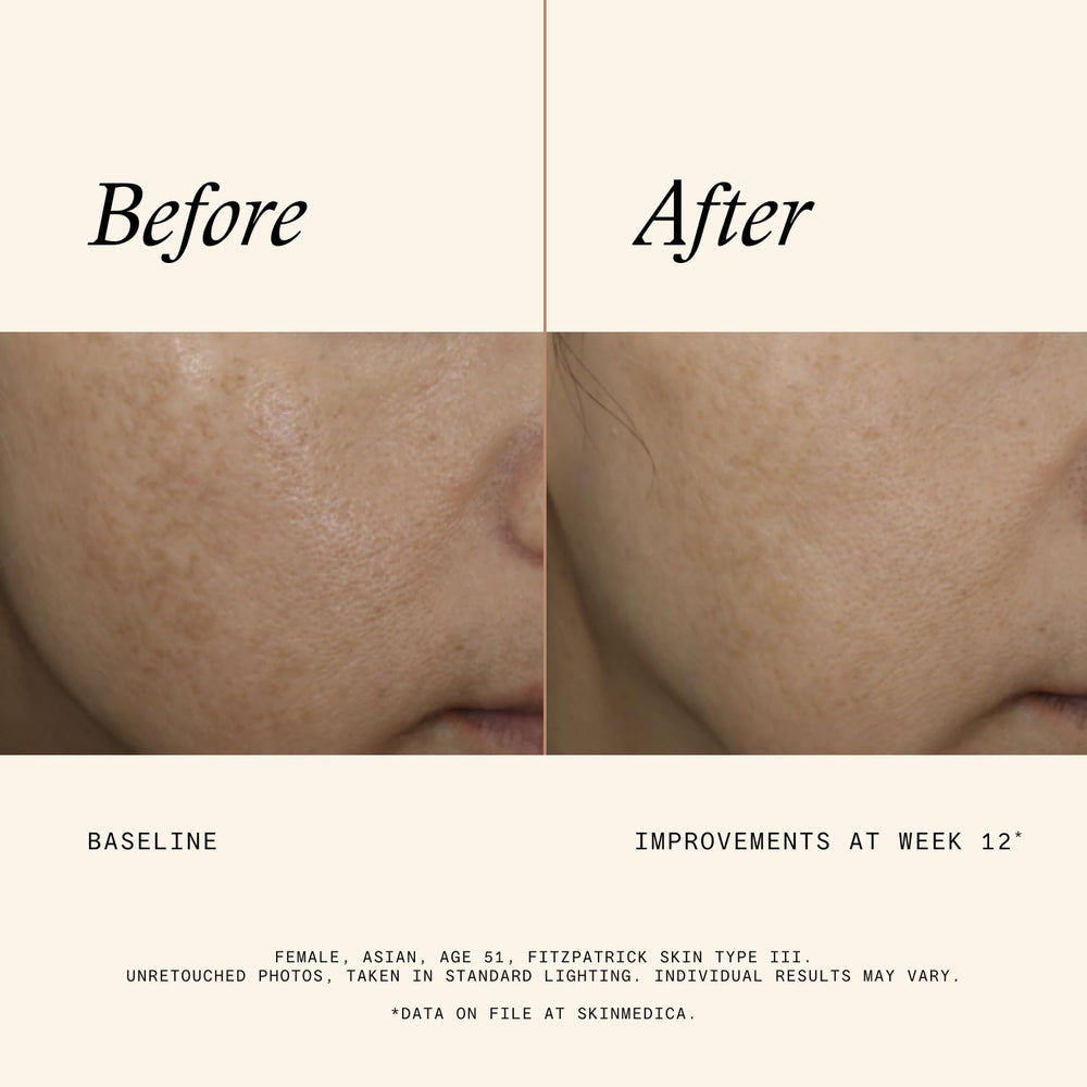 Close-up texture of SkinMedica Even & Correct serum for lightweight feel