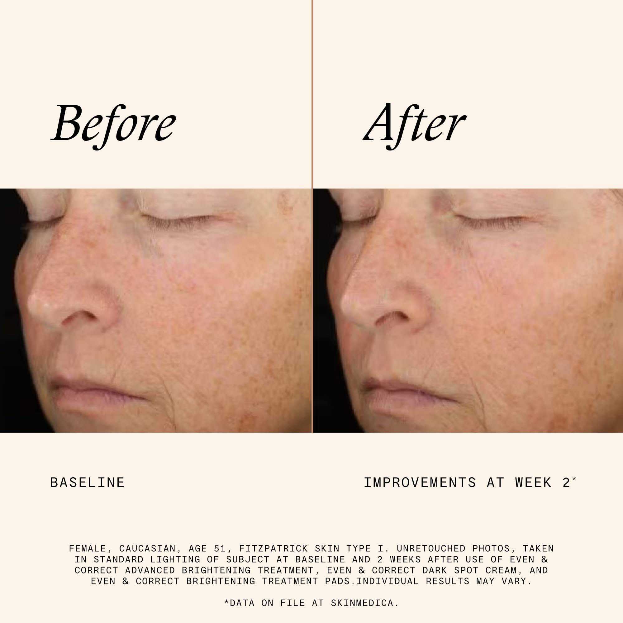 Pad in hand demonstrates prep for subsequent skincare treatments.