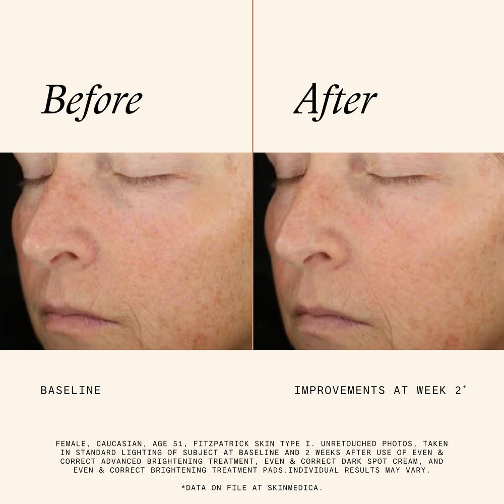Pad in hand demonstrates prep for subsequent skincare treatments.