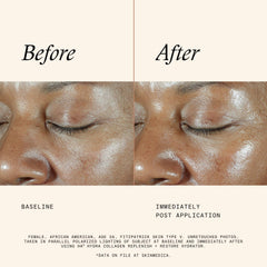 SkinMedica HA5 avocado oil esters highlight nourishing touch.