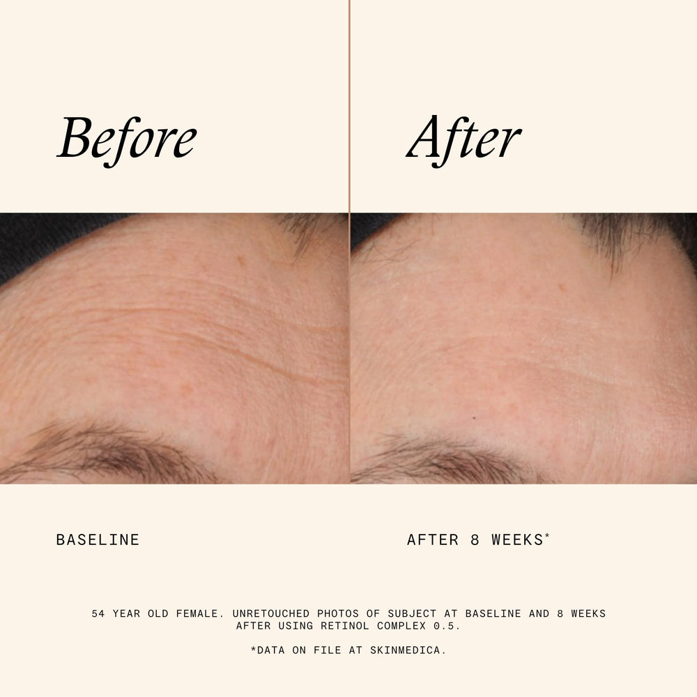 Cream swirl of SkinMedica Retinol 0.5 Complex indicating smooth absorption