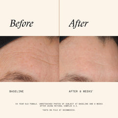 Cream swirl of SkinMedica Retinol 0.5 Complex indicating smooth absorption