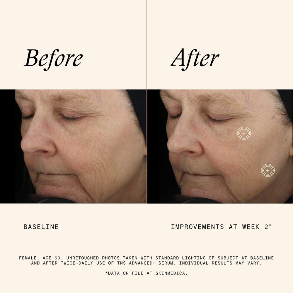 Dropper dispensing SkinMedica TNS Advanced+ Serum during morning routine.
