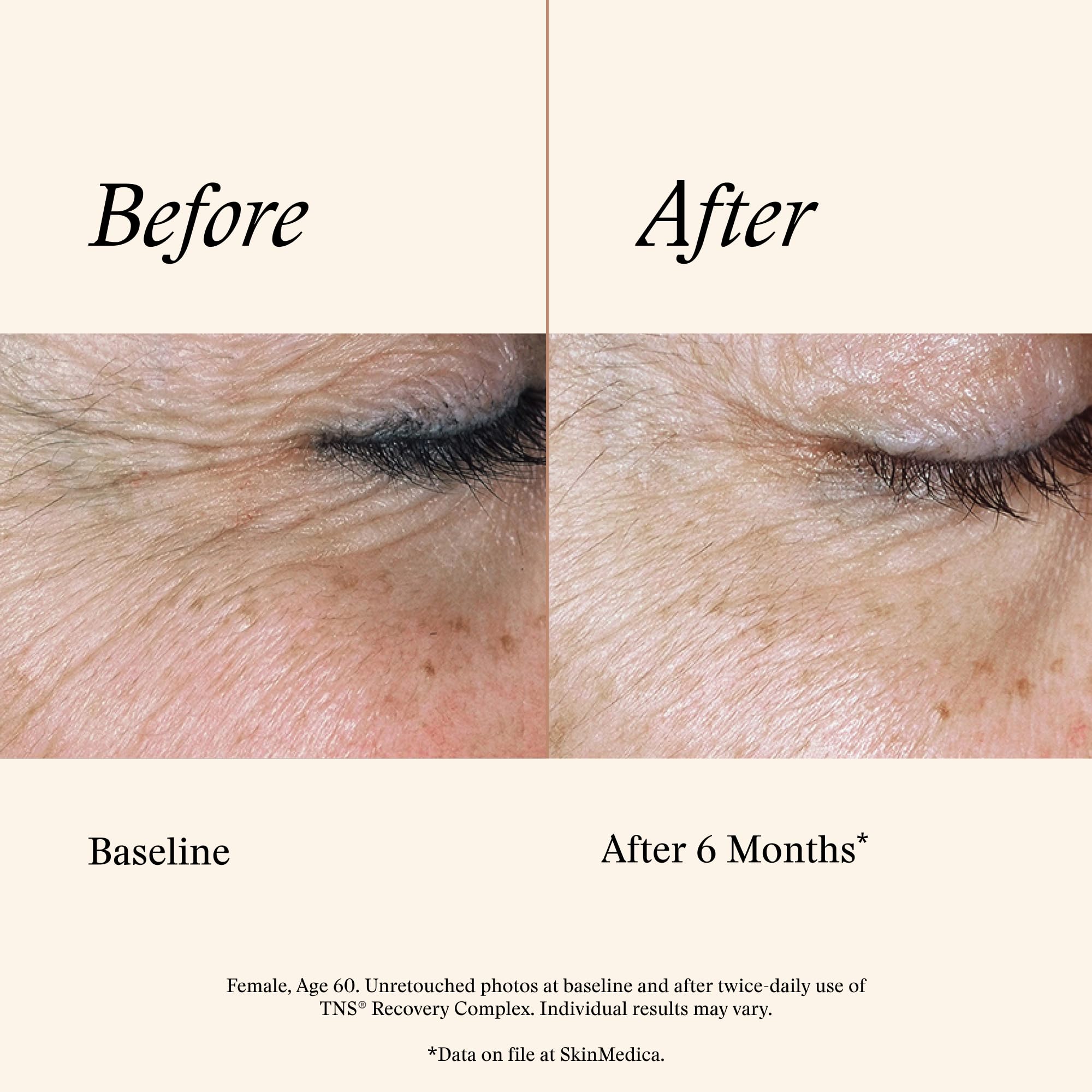 SkinMedica TNS Recovery Complex gel texture appears light and fast absorbing