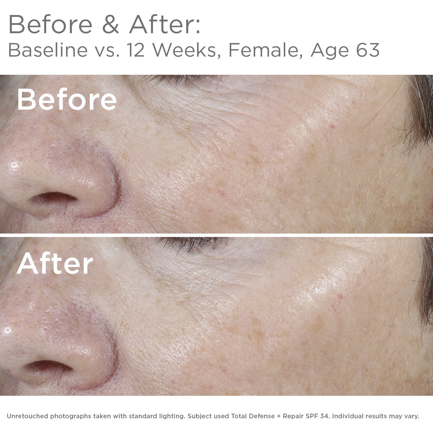 SkinMedica Total Defense + Repair SPF 34 close-up texture highlights lightweight feel.