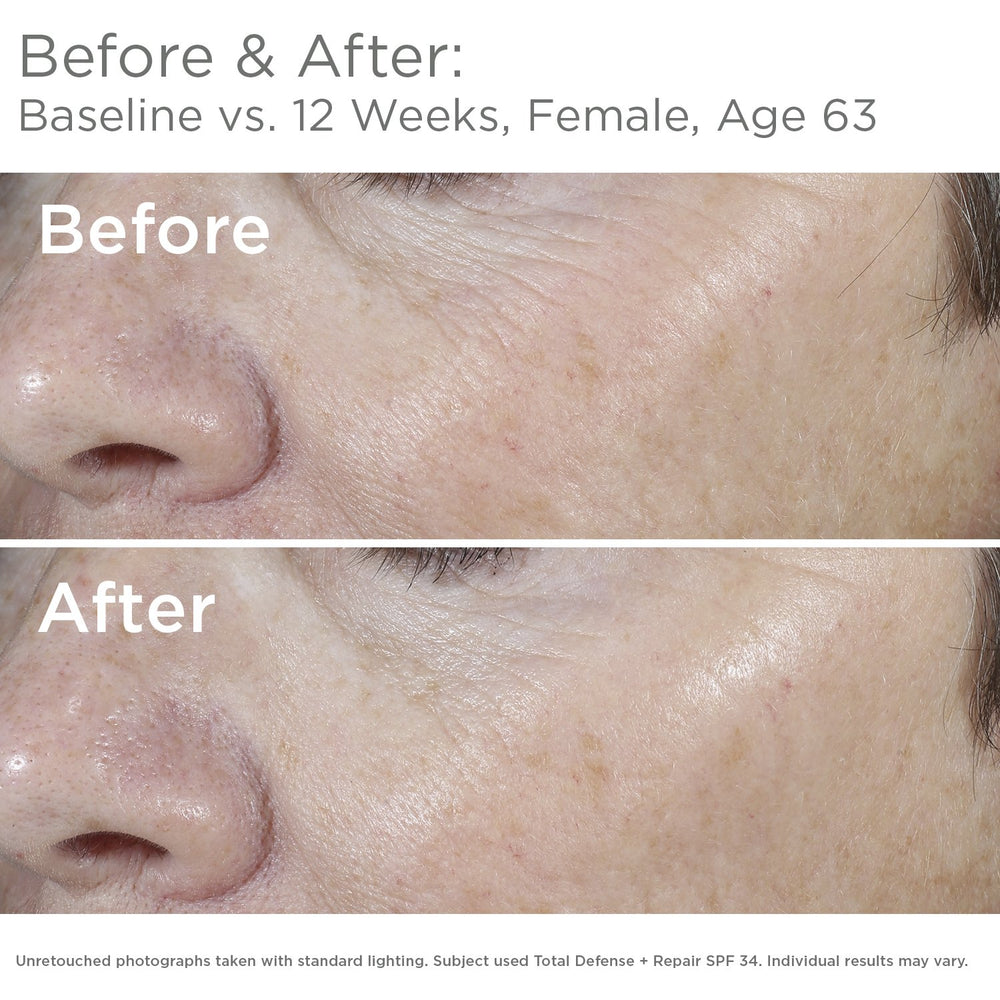 SkinMedica Total Defense + Repair SPF 34 close-up texture highlights lightweight feel.