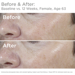 SkinMedica Total Defense + Repair SPF 34 close-up texture highlights lightweight feel.