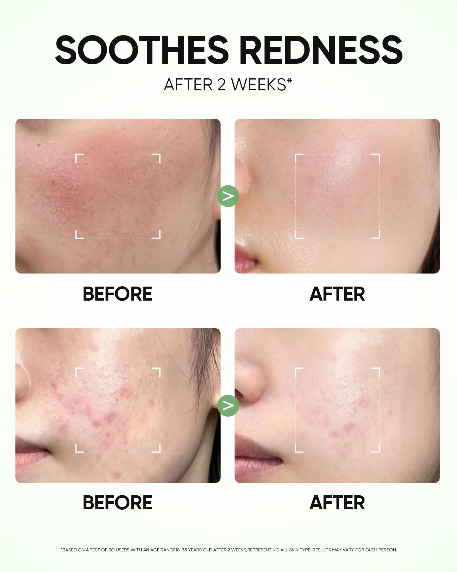 Mascarilla SKINTIFIC en barra de arcilla de artemisa, aplicación directa en zonas problemáticas.